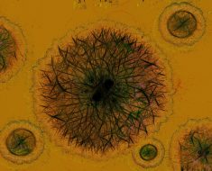 cauzele toxiinfectiei alimentare