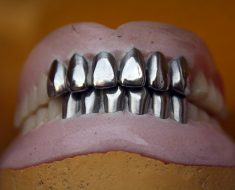 curatare proteze dentare