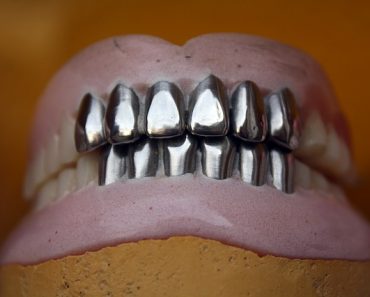 curatare proteze dentare